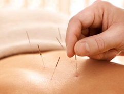 中医针灸法的特点【全】
